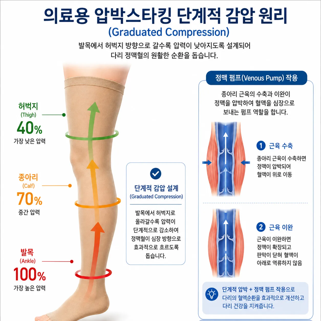 발목에서 허벅지 방향으로 올라갈수록 압력이 부드럽게 낮아지는 감압 설계 원리와 다리 정맥의 흐름을 시각화한 의학 인포그래픽